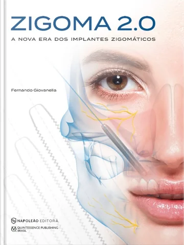 Capa do livro ZIGOMA 2.0 — A nova era dos implantes zigomáticos, de Fernando Giovanella