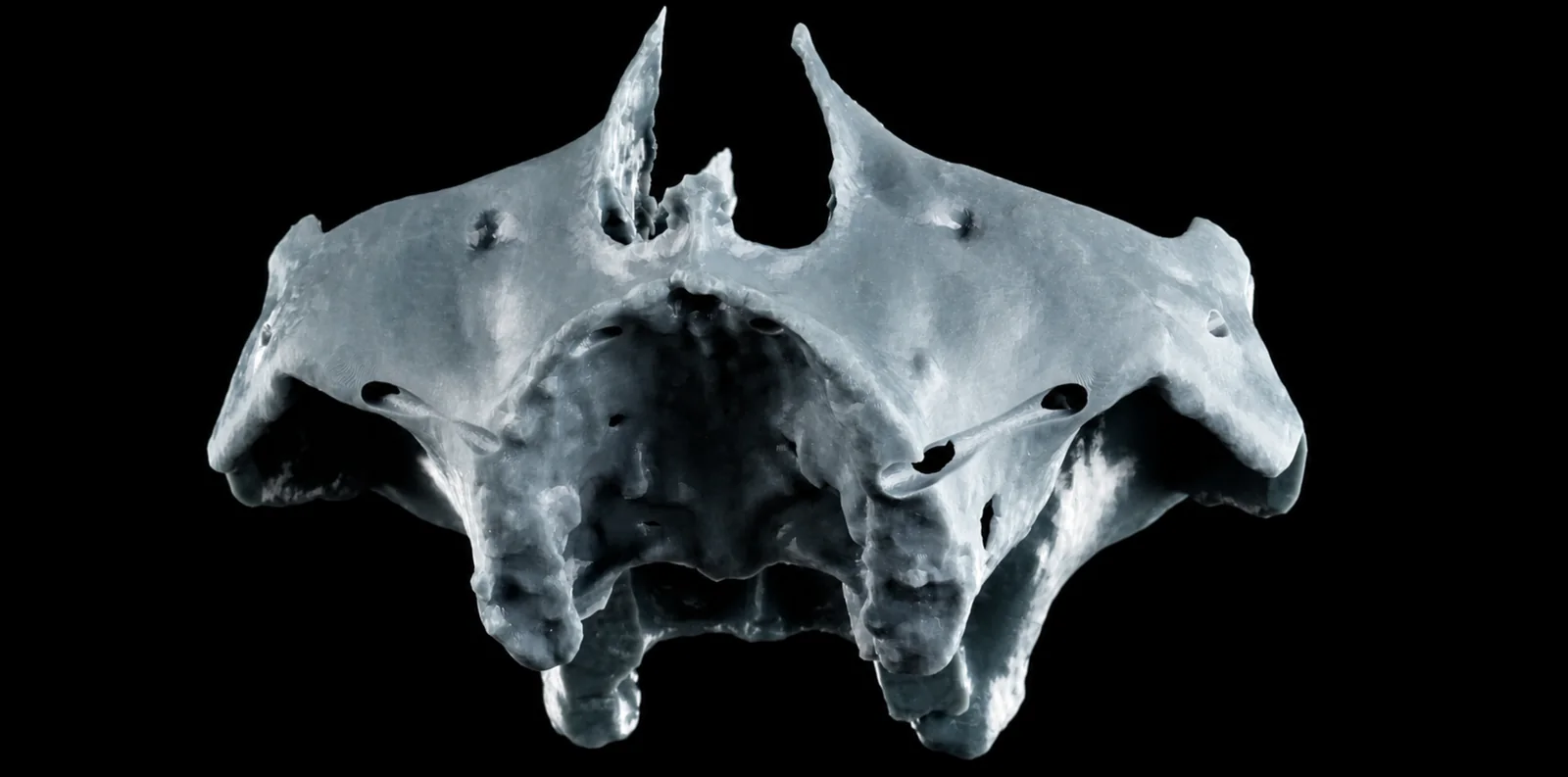 Protótipo impresso em 3D do terço médio da face, com os canais das osteotomias zigomáticas já abertos dos dois lados