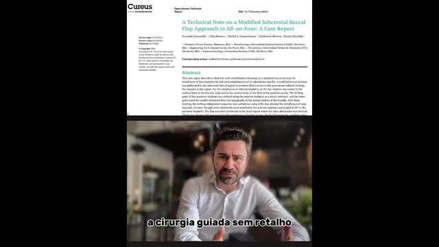 Capa do vídeo: O ponto cego do All-on-4: nova abordagem minimamente invasiva